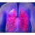 GSK presentará sus últimas investigaciones en el ámbito respiratorio